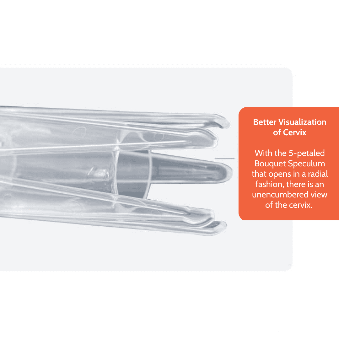 Bouquet Speculum™ thumbnail image 3