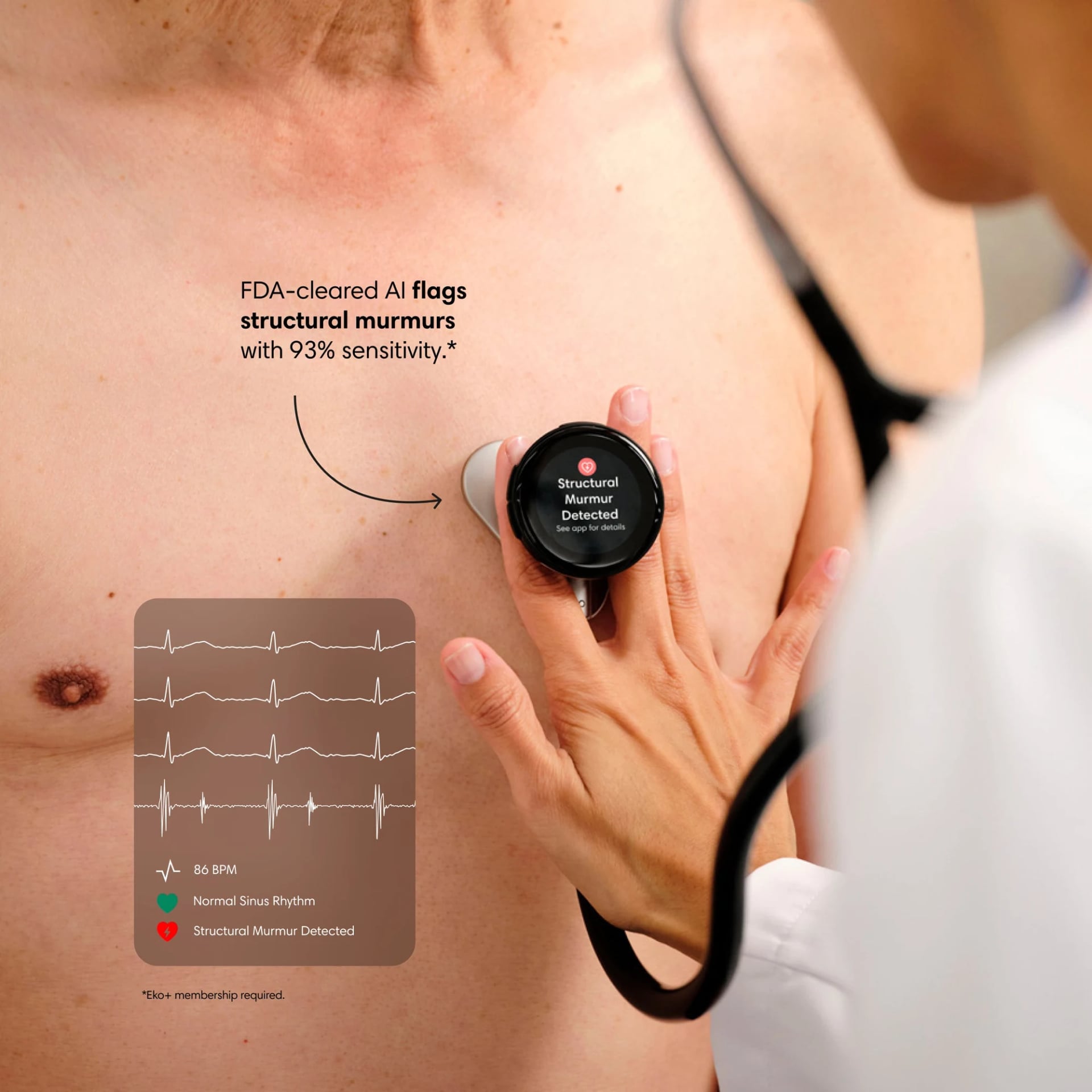 Eko CORE 500 on a patient’s chest with an AI murmur result Eko CORE 500 on a patient’s chest with an AI murmur result